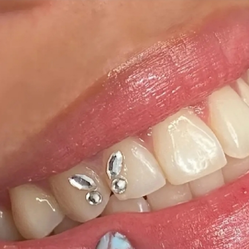 Butterfly Tooth Gem Kits 💎 Decals design unisex DIY Pink Blue Green